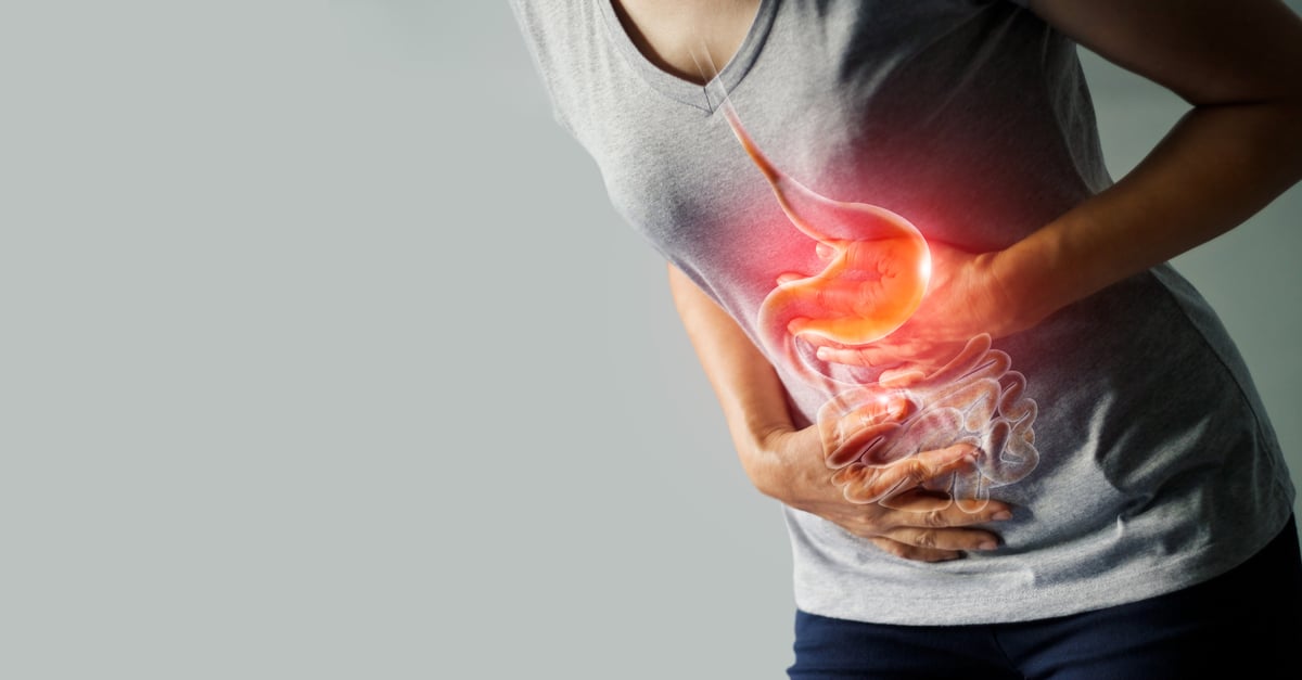 15 formas de prevenir naturalmente la acidez estomacal