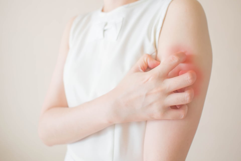skin rash