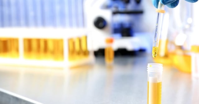 10 Things You Can Do with Your Own Urine