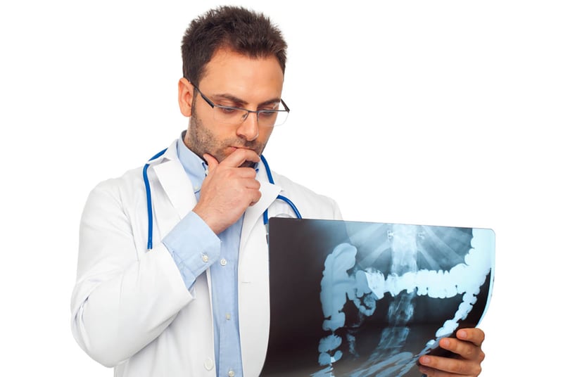 doctor, radiografía, cáncer de colon, salud, enfermedad