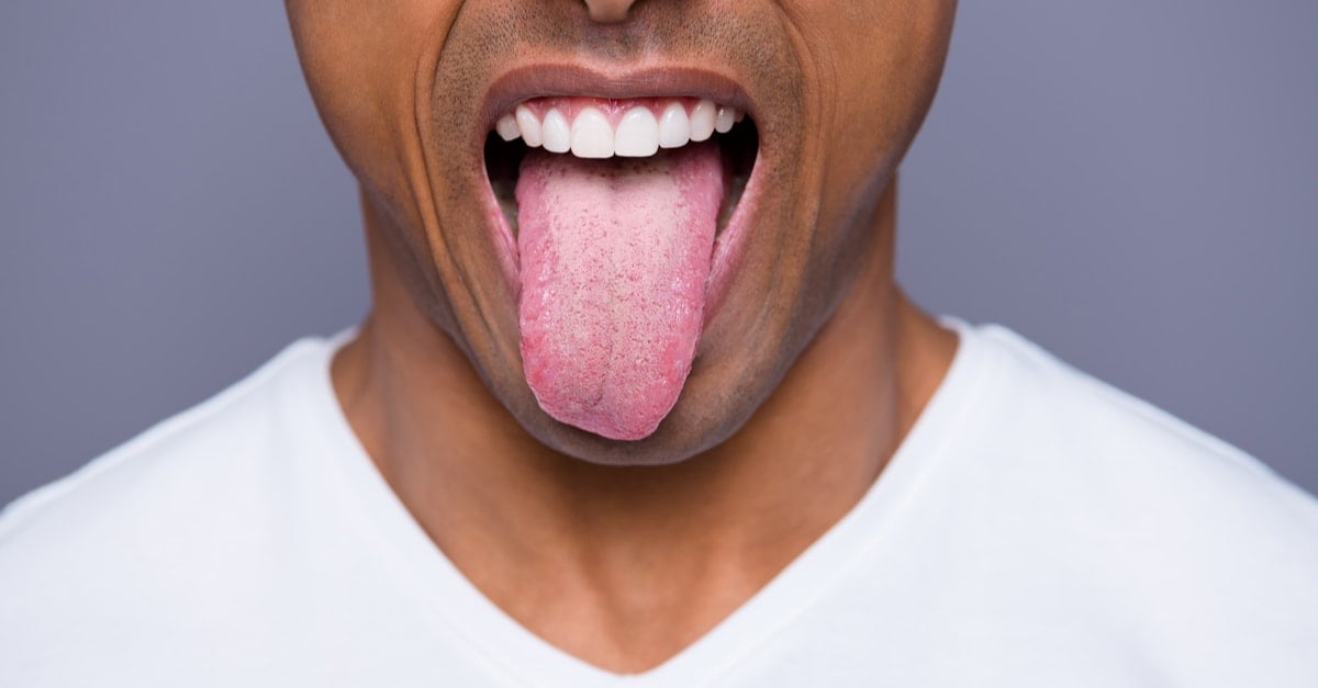 Tongue problems: symptoms and treatments