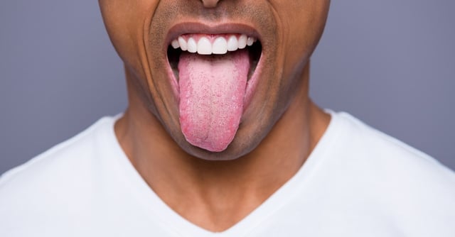 Tongue problems: symptoms and treatments