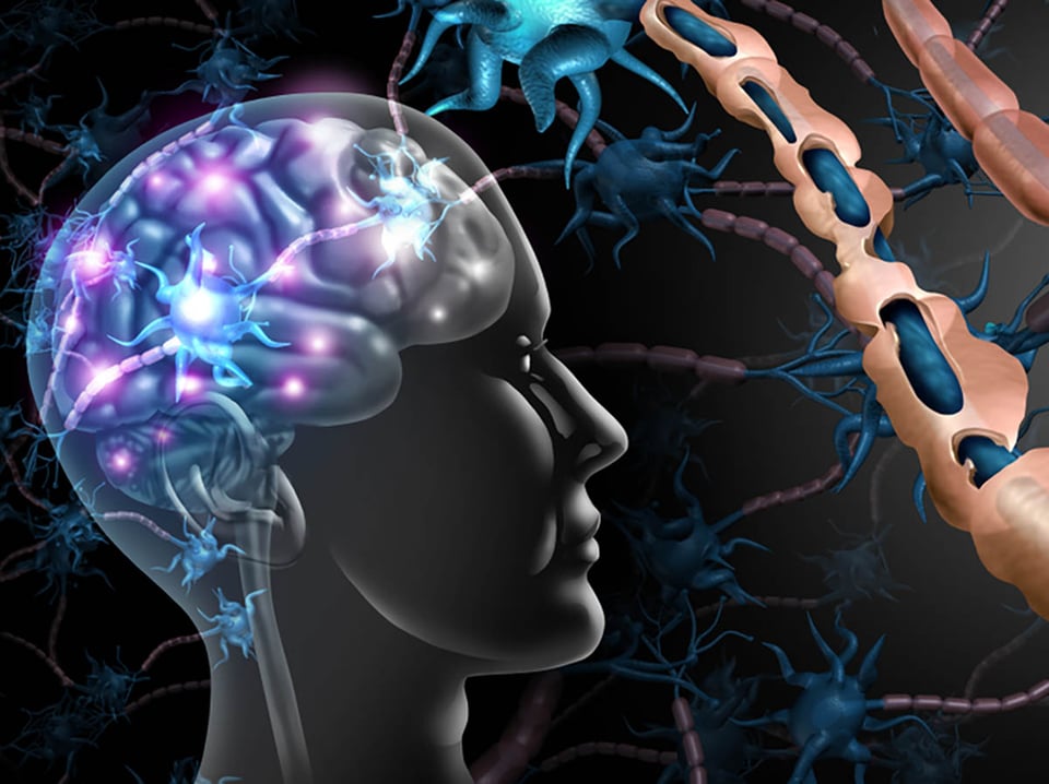 The impact of lifestyle choices on managing multiple sclerosis