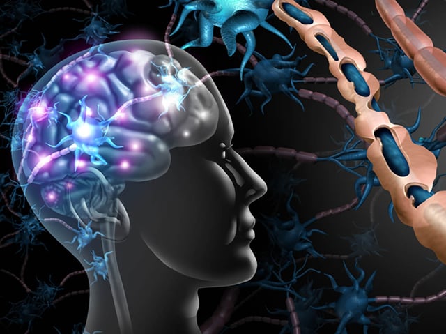 The impact of lifestyle choices on managing multiple sclerosis