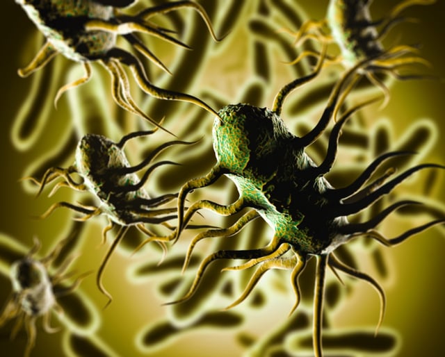Ordenan recall de mantequilla por posible contaminación bacteriana