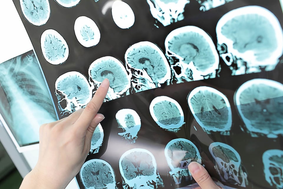 radiografías, historial médico, exámenes físicos, pruebas, MundoNOW