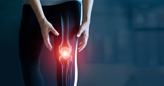 Why do my knees crack? 5 Reasons to worry