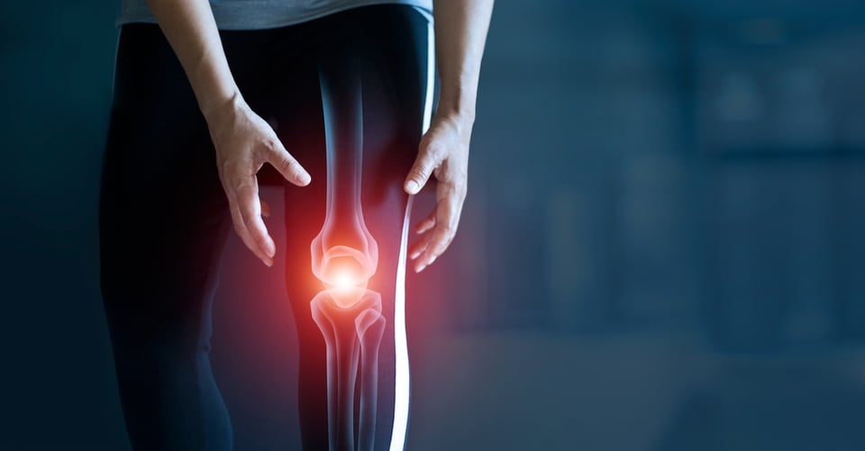 ¿Por qué truenan mis rodillas? Razones para preocuparse