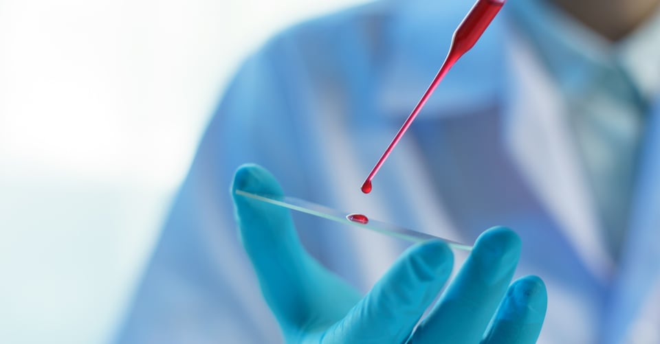 True Blood: 10 razones por las que debes conocer tu tipo de sangre