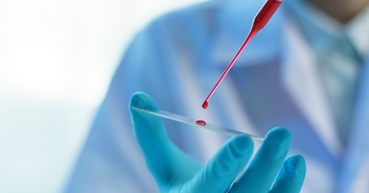 True Blood: 10 razones por las que debes conocer tu tipo de sangre