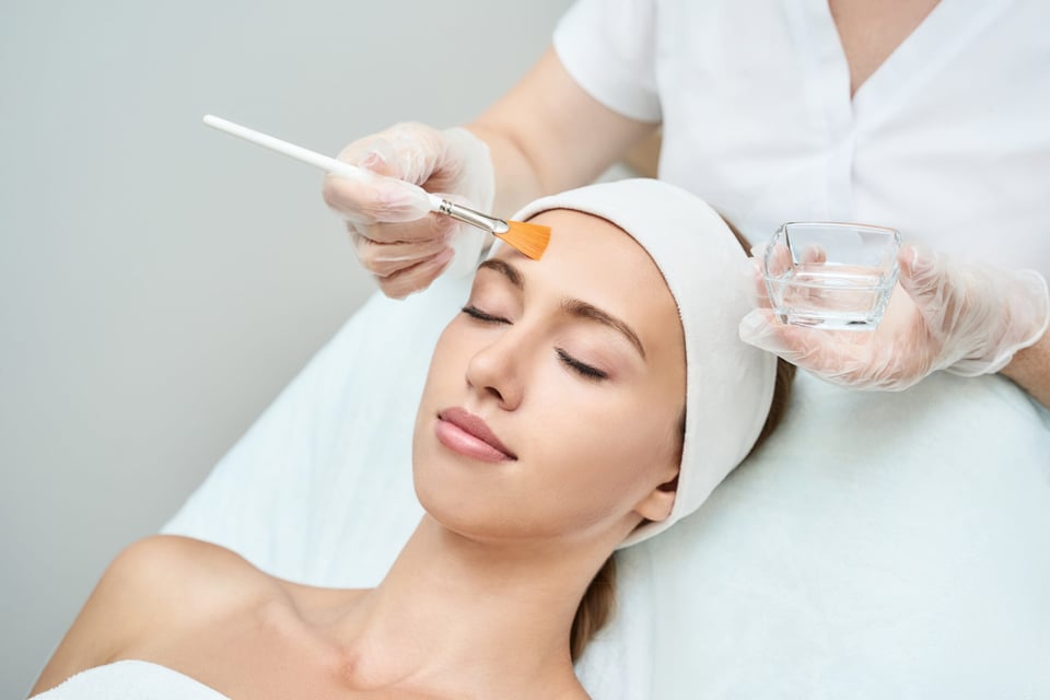 exfoliación química