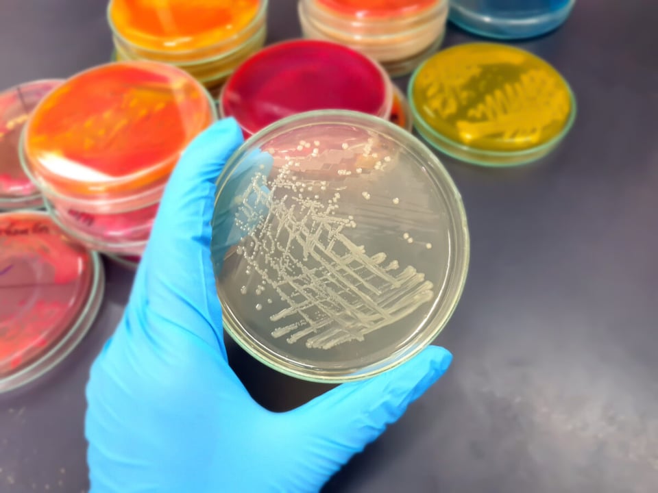 Department of Health, salmonella infection, fecal matter, symptoms, diarrhea