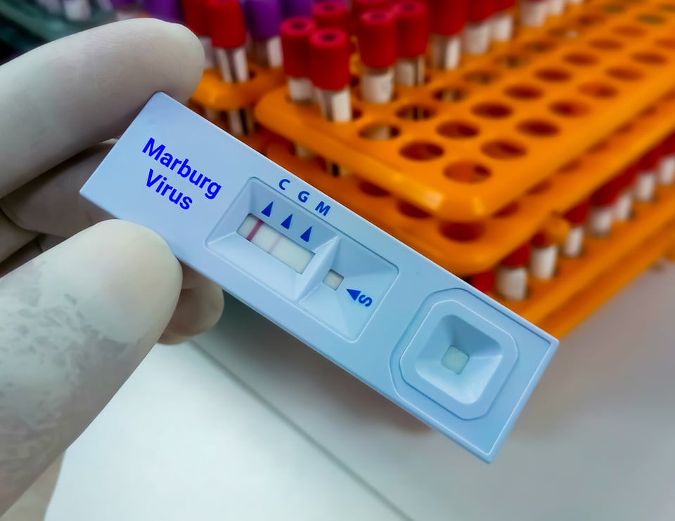 El virus de Marburgo
