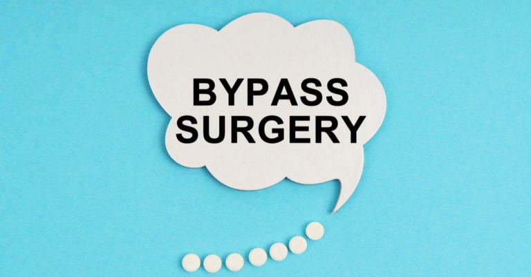 Lo que necesitas saber de una cirugía bypass gástrica: 12 datos