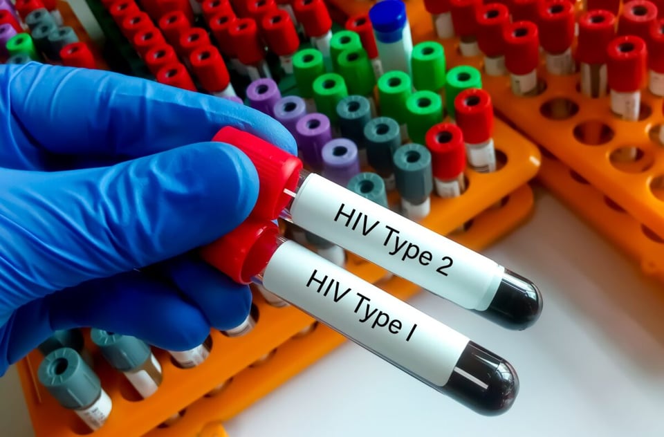 HIV, test, STDs