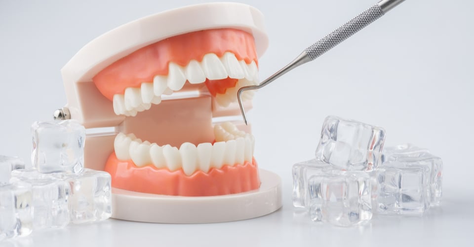 Un modelo dental con dientes y hielos