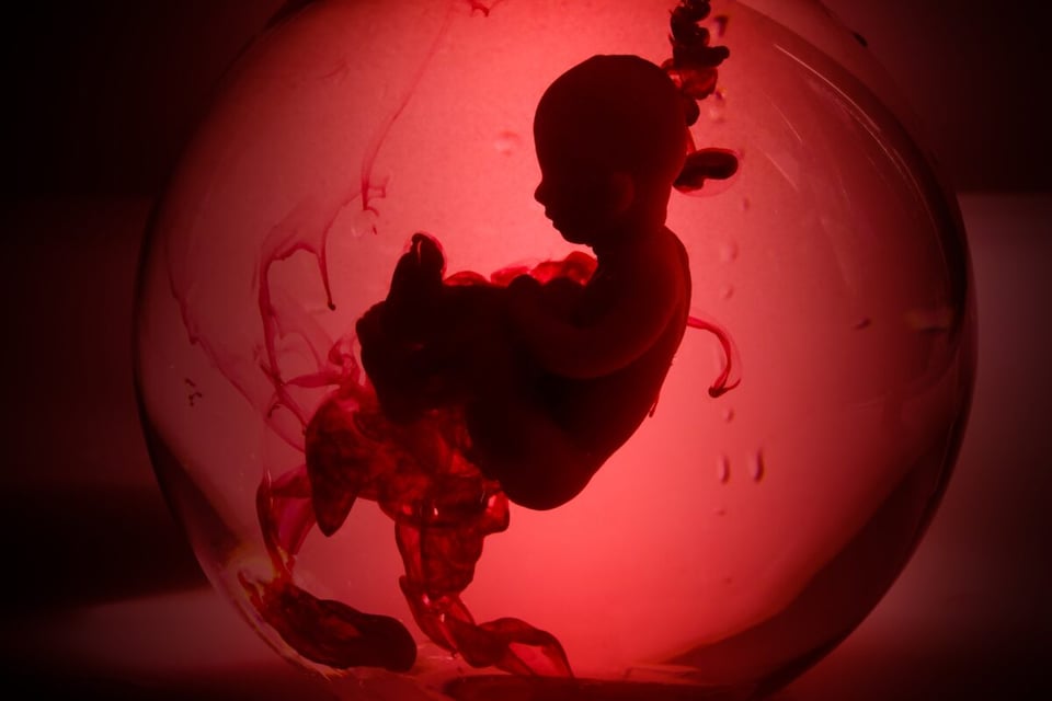 bebé, aborto espontáneo, pérdida, fisionomía, biología