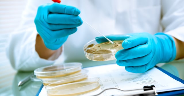 ¿Qué es la listeria y por qué debe preocuparnos?