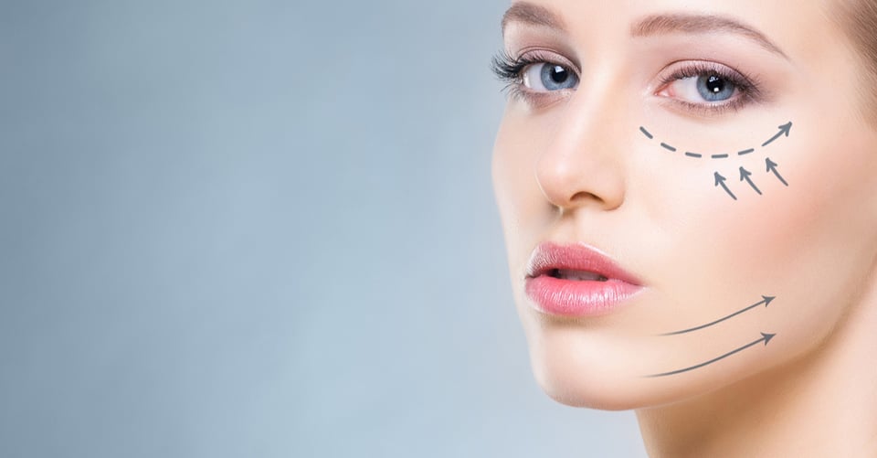 ¿Qué es el estiramiento facial líquido? 10 cosas que necesitas saber de los estiramientos faciales no quirúrgicos