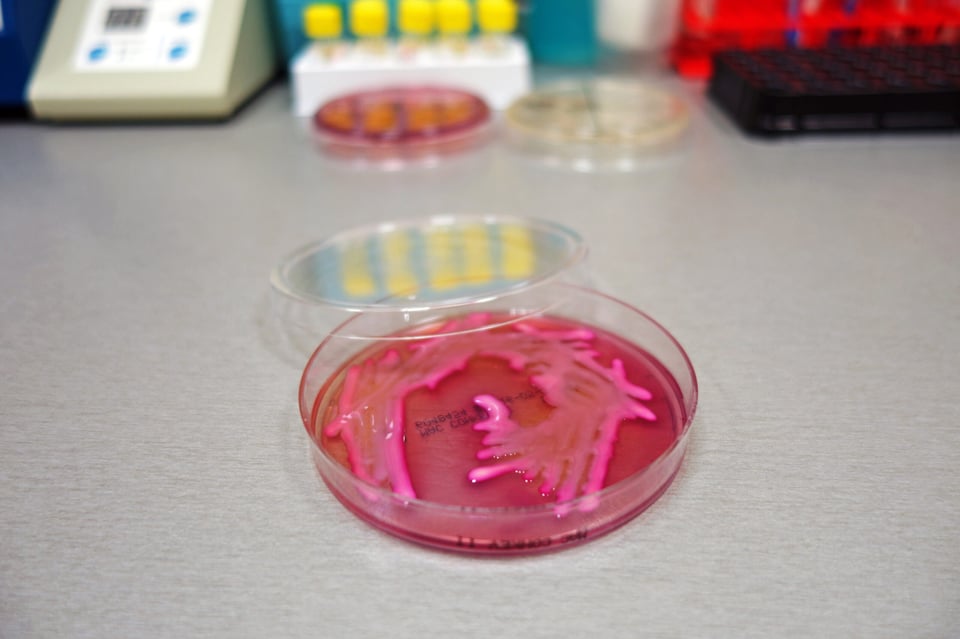 ¿Qué es la Klebsiella pneumoniae?