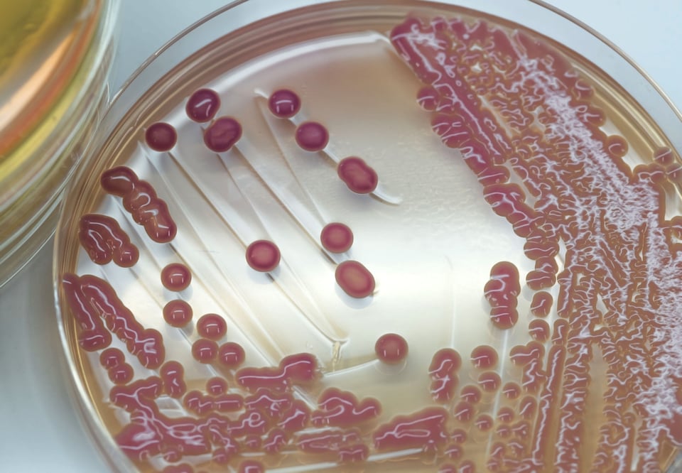 Four dead in Seattle bacteria outbreak reported