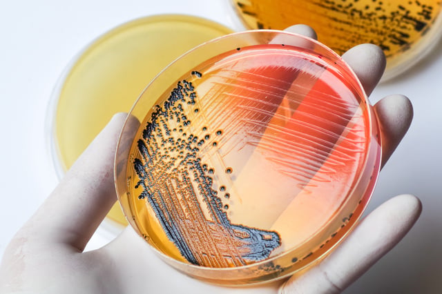 Emiten alerta por bacteria ‘Shigella’, la cual es resistente a los medicamentos (FOTOS)