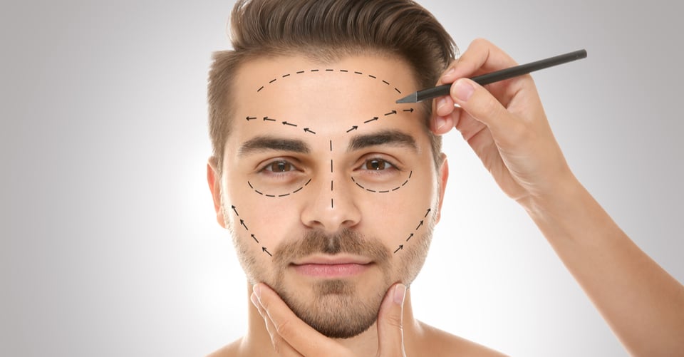 Rellenos faciales: 15 cosas que debes saber antes de aplicarlos