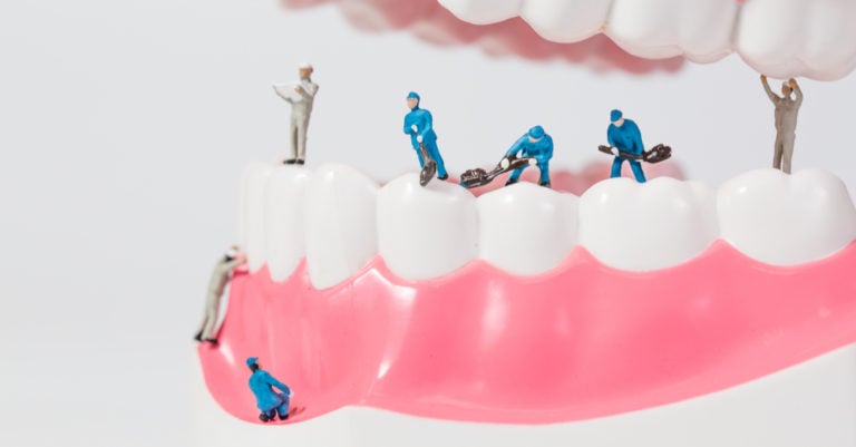 10 alimentos que aclaran de manera natural los dientes