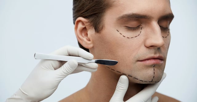 Plastic surgery disasters: 12 stars who regret plastic surgery