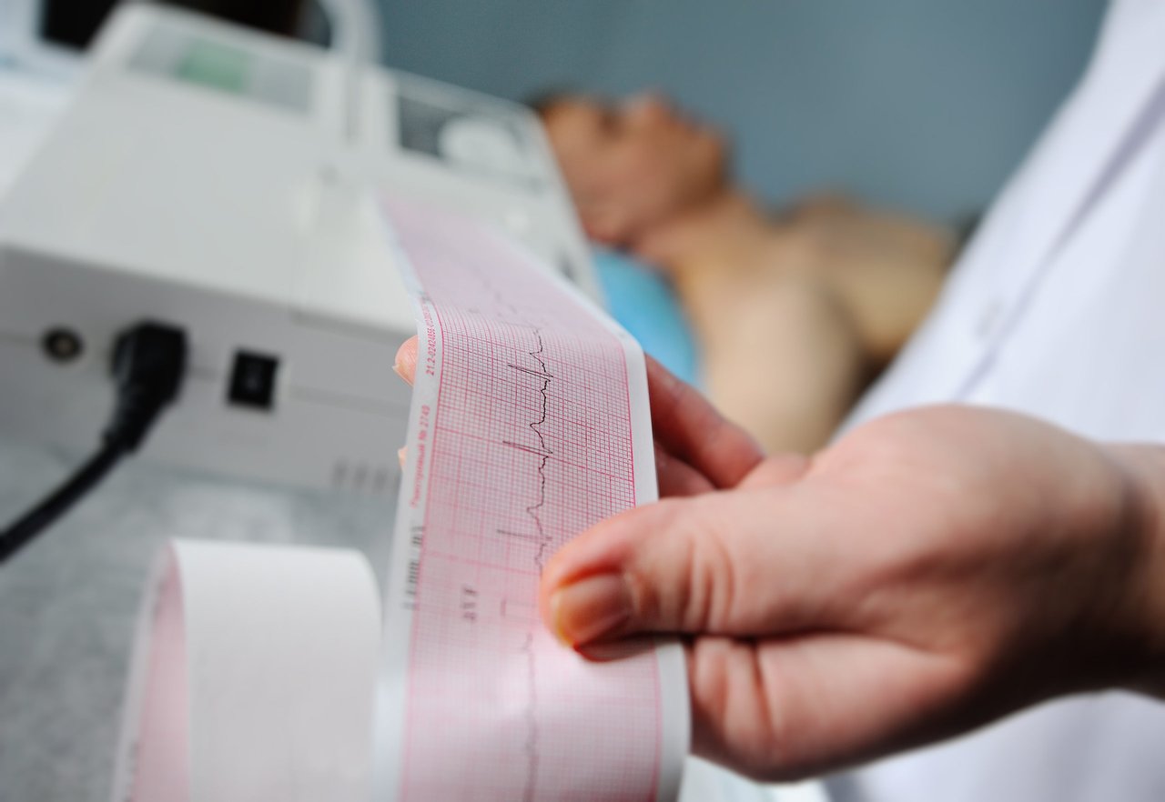 What is heart rate and what are normal values?