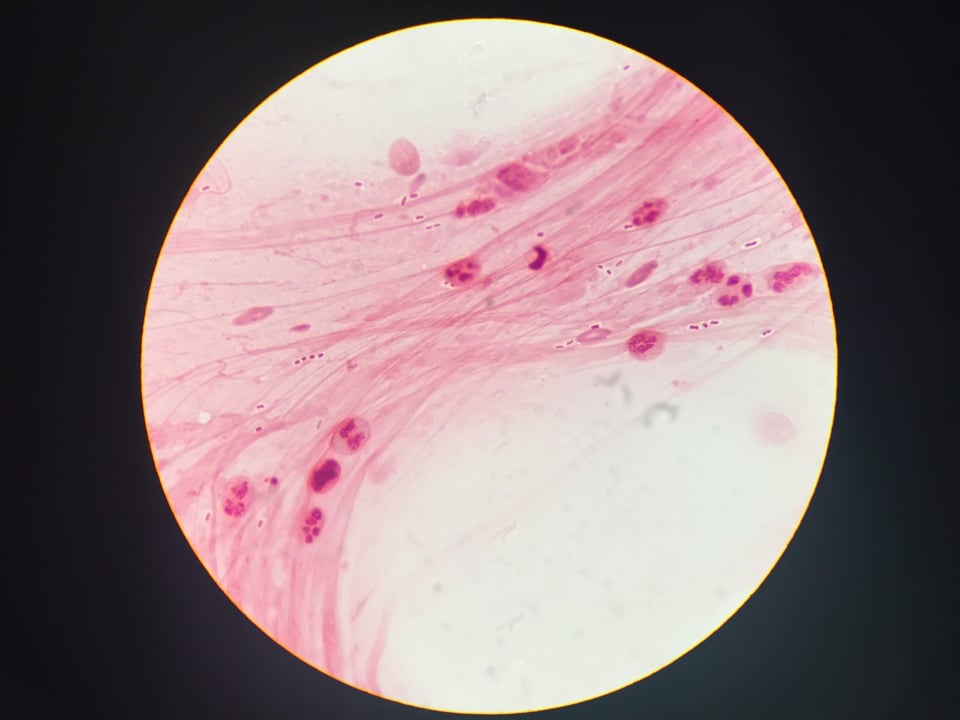 Four dead in US bacteria outbreak