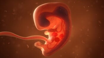 Doctores señalaron que era urgente remover el feto vivo de la cabeza de la niña