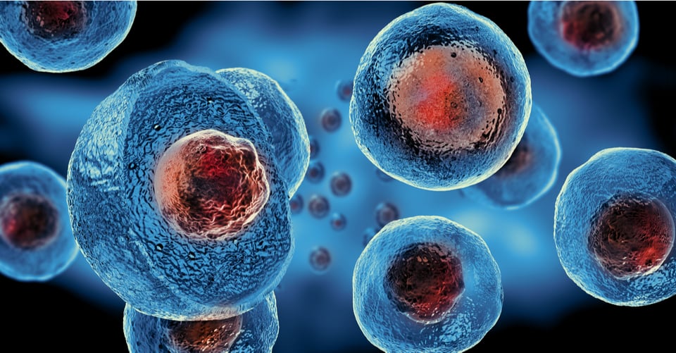 ¿Qué es el cáncer? Los 4 diferentes tipos que matan
