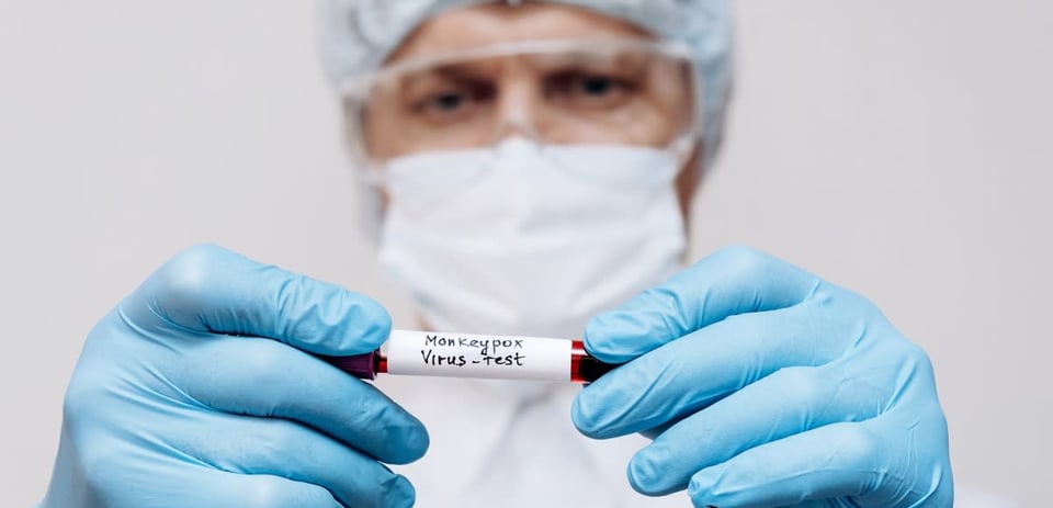 First confirmed case of monkeypox reported in Mexico