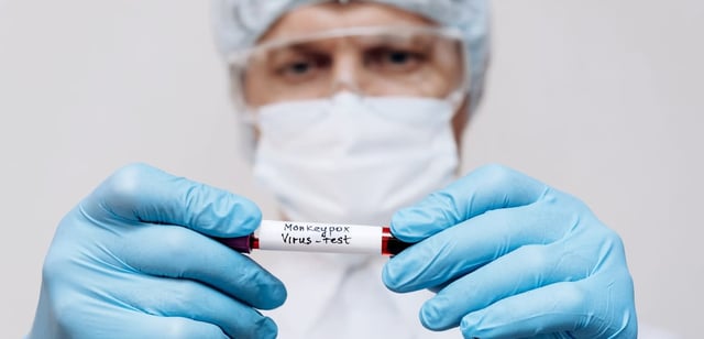 First confirmed case of monkeypox reported in Mexico