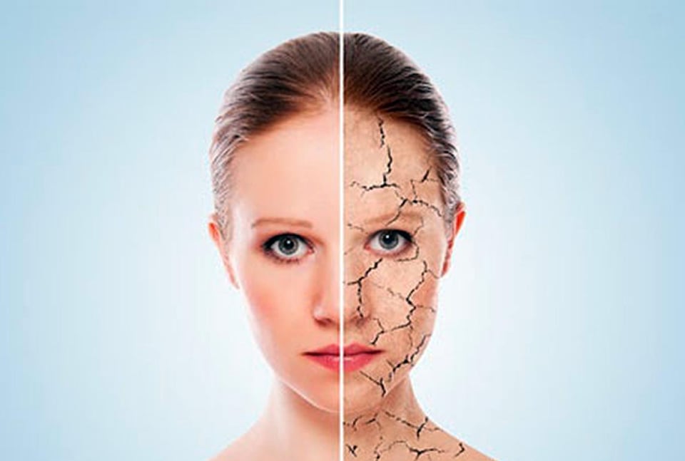 woman, dry skin, normal skin, concept