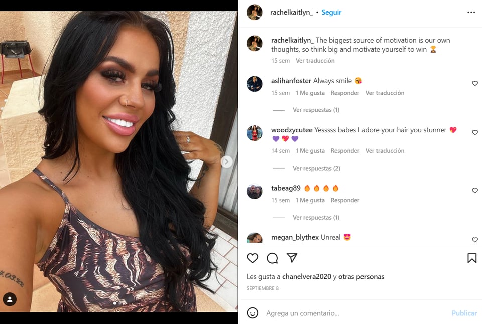 MUERE LA MODELO BRITÁNICA RACHEL MEE
