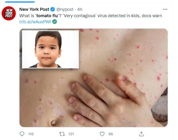 ¡PRESTE ATENCIÓN CON 'NUEVA' ENFERMEDAD!