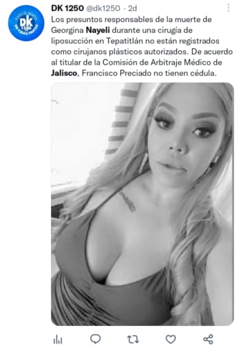 Mexicana muere tras liposucción