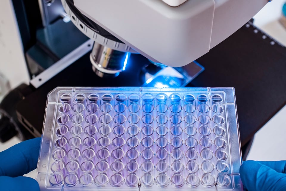Legionnaires' Disease Deaths, Legionella, pneumonia, prevention, symptoms, contaminated water, health, MundoNOW, fever, chills, cough, risk, maintenance, bacteria, infection.