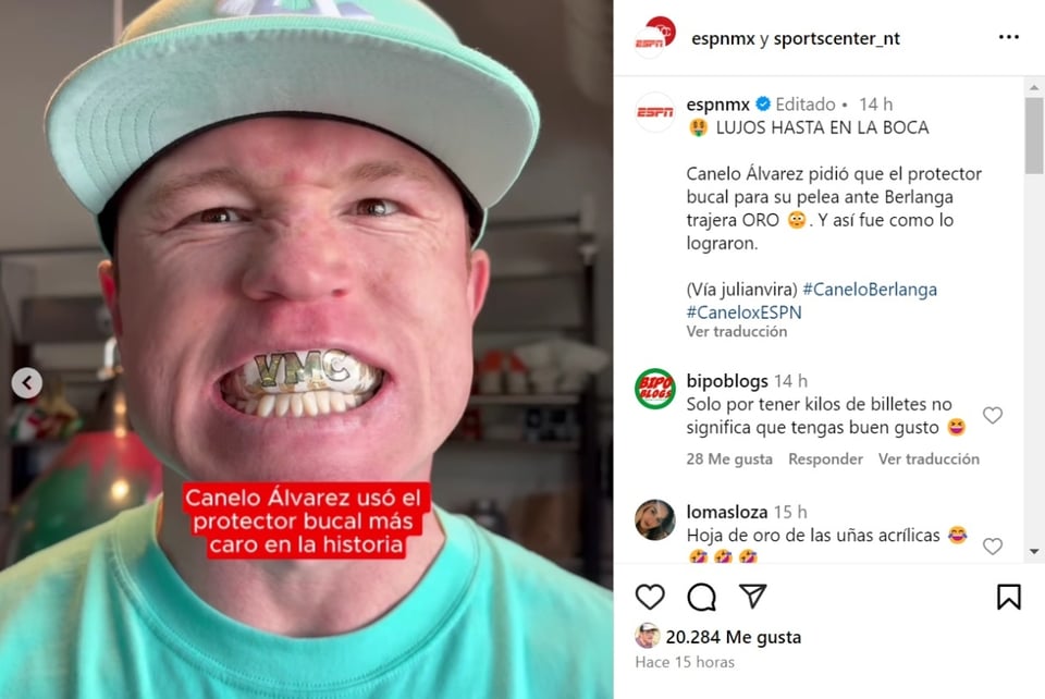 Canelo Álvarez protector bucal, oro, costo, video, MundoNOW