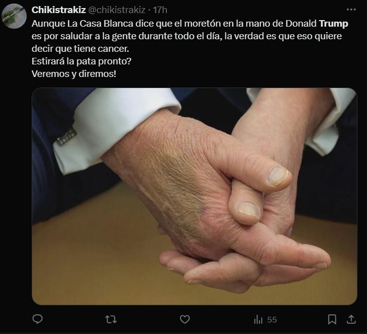 trump, moretones, manos, liderazgo, apretones