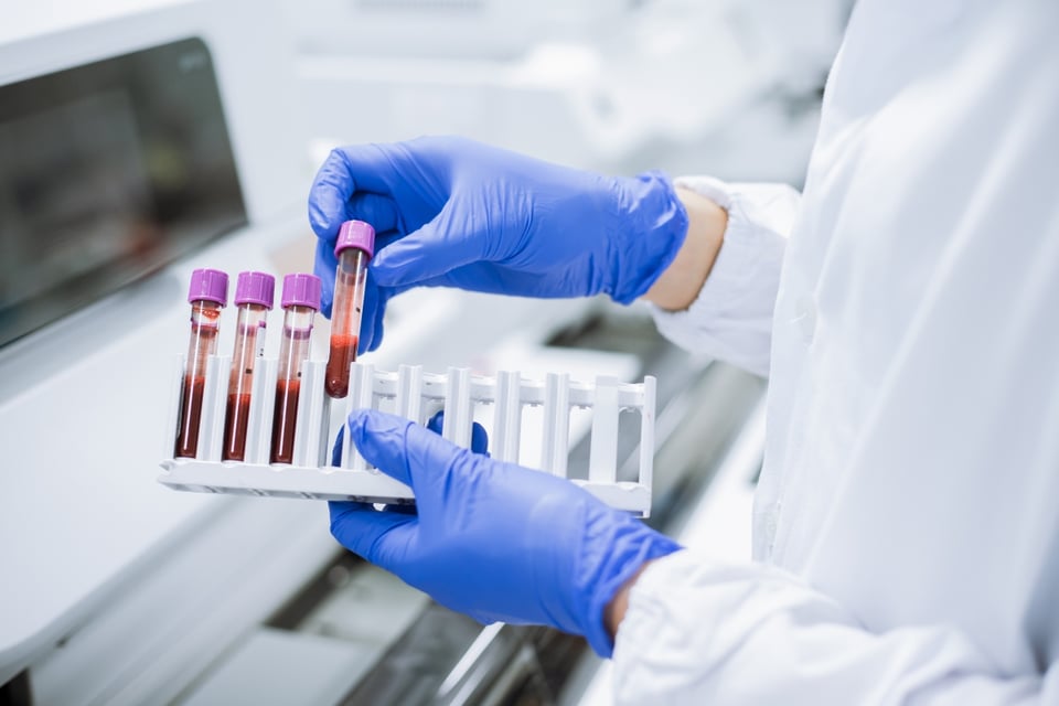 Test sanguíneo, FDA, Alzhéimer, MundoNOW