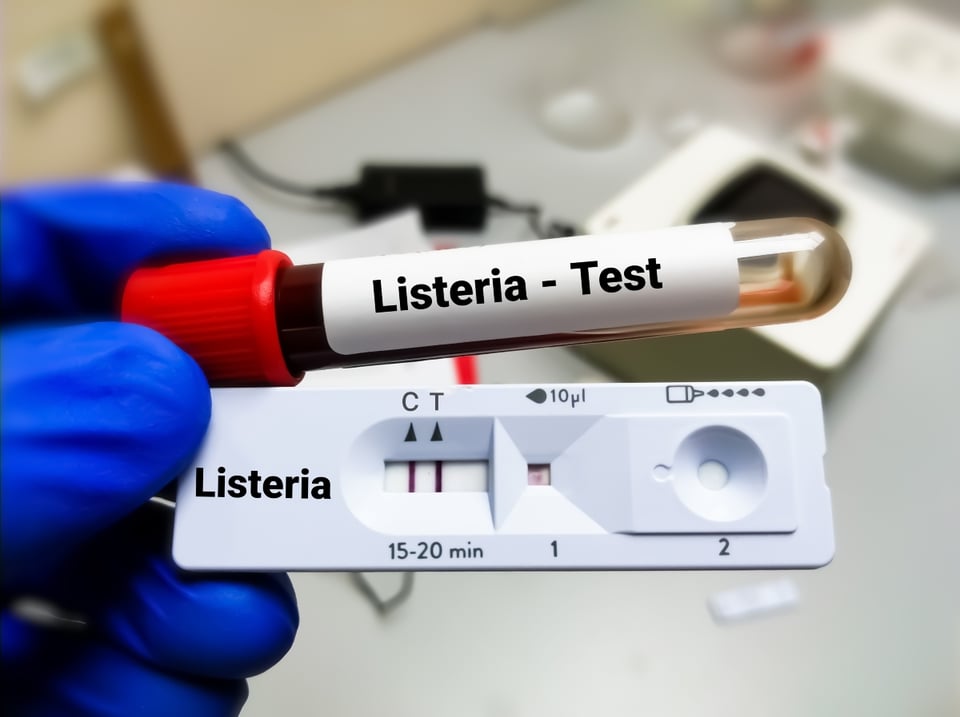 Listeria en batidos congelados, muertes, recall, MundoNOW