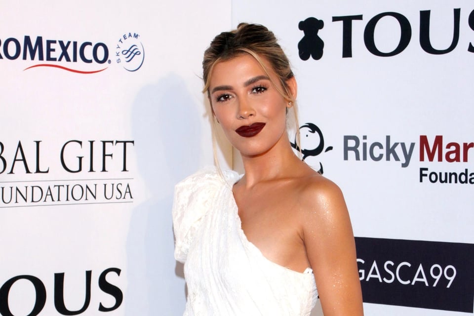Michelle Salas revela su lucha contra el melasma