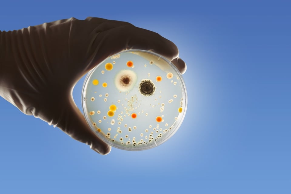 listeria, Walmart, comidas congeladas MundoNOW