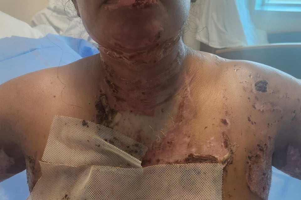 Hialeah, Claudia Bolívar, Explosión doméstica MundoNOW