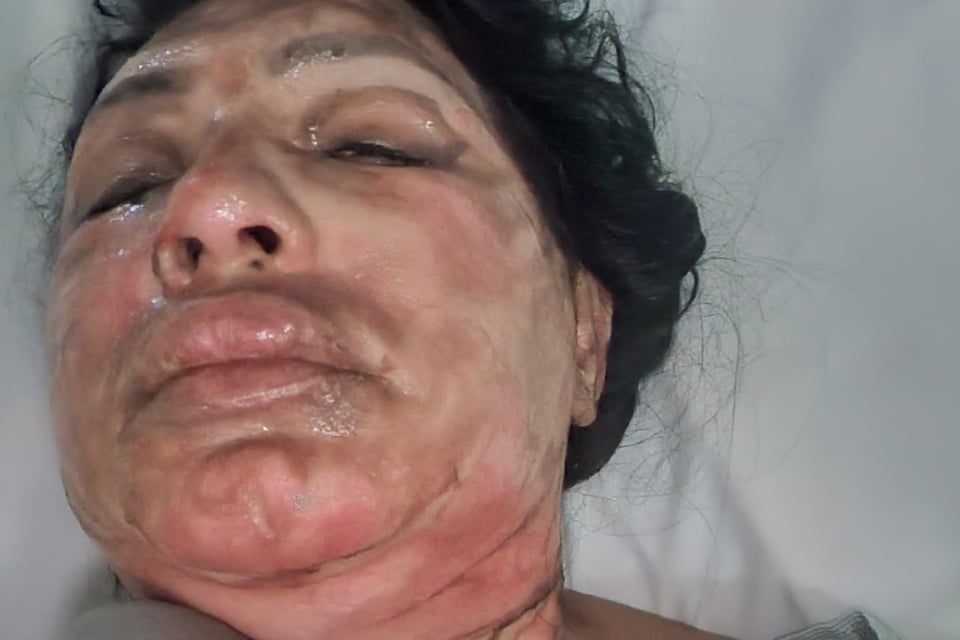 Hialeah, Claudia Bolívar, Explosión doméstica MundoNOW