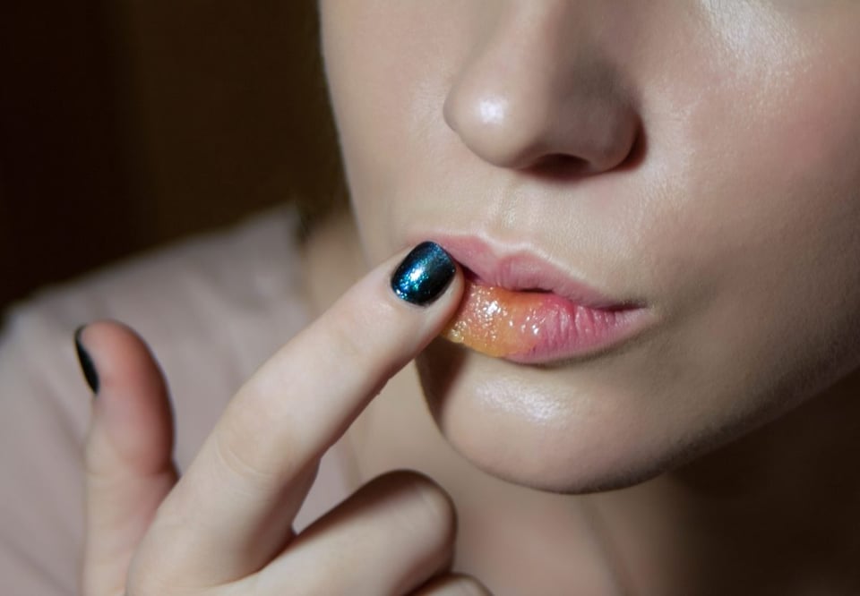 labios quemados por el frio