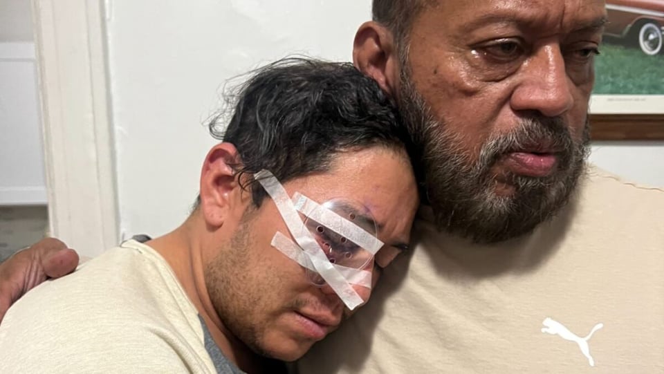 violence, New York, Hispanic, view, ocular